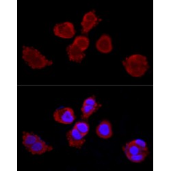 Keratin, Type II Cytoskeletal 3 (KRT3) Antibody