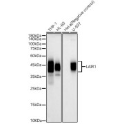 Western blot analysis of various lysates, using LAIR1 Antibody at 1/1000 dilution. Secondary antibody: HRP-conjugated Goat anti-Rabbit IgG (H+L) at 1/10000 dilution. Lysates/proteins: 25 µg per lane. Blocking buffer: 3% nonfat dry milk in TBST. Negative control (NC): HeLa Exposure time: 20s.