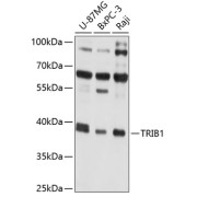 Western blot analysis of various lysates using TRIB1 Antibody at 1/1000 dilution. Secondary antibody: HRP-conjugated Goat anti-Rabbit IgG (H+L) at 1/10000 dilution. Lysates/proteins: 25 µg per lane. Blocking buffer: 3% nonfat dry milk in TBST. Exposure time: 5s.