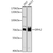 Western blot analysis of various lysates using GRHL2 Antibody at 1/1000 dilution. Secondary antibody: HRP-conjugated Goat anti-Rabbit IgG (H+L) at 1/10000 dilution. Lysates/proteins: 25 µg per lane. Blocking buffer: 3% nonfat dry milk in TBST. Exposure time: 30s.