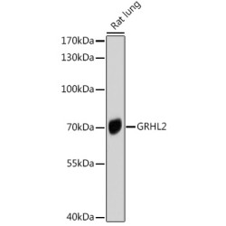 Grainyhead-Like Protein 2 Homolog (GRHL2) Antibody