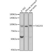 Western blot analysis of various lysates using TAS1R3 Antibody at 1/1000 dilution. Secondary antibody: HRP-conjugated Goat anti-Rabbit IgG (H+L) at 1/10000 dilution. Lysates/proteins: 25 µg per lane. Blocking buffer: 3% nonfat dry milk in TBST. Exposure time: 1s.