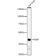 Western blot analysis of lysates from Rat brain, using FKRP Antibody at 1/400 dilution. Secondary antibody: HRP-conjugated Goat anti-Rabbit IgG (H+L) at 1/10000 dilution. Lysates/proteins: 25 µg per lane. Blocking buffer: 3% nonfat dry milk in TBST. Exposure time: 60s.