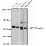 Western blot analysis of various lysates using GLUT2/SLC2A2 Rabbit antibody at 1：1000 dilution. Secondary antibody: HRP-conjugated Goat anti-Rabbit IgG (H+L) at 1/10000 dilution. Lysates/proteins: 25 µg per lane. Blocking buffer: 3% nonfat dry milk in TBST. Exposure time: 3s.