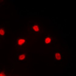 Myocyte-Specific Enhancer Factor 2C (MEF2C) Antibody