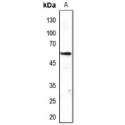 Western blot analysis of MEF2C expression in zebrafish whole cell lysates.