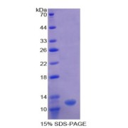 SDS-PAGE analysis of Human OAS1 Protein.