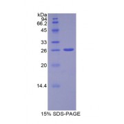 SDS-PAGE analysis of Human ADAM10 Protein.