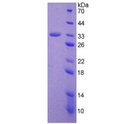 SDS-PAGE analysis of Human ADAM28 Protein.