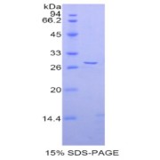 SDS-PAGE analysis of Rat ADAM5 Protein.