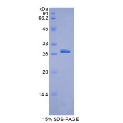 SDS-PAGE analysis of Human ADAM9 Protein.