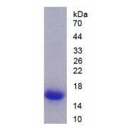 SDS-PAGE analysis of recombinant Rat A Disintegrin And Metalloproteinase With Thrombospondin 1 (ADAMTS1) Protein.