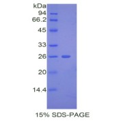 SDS-PAGE analysis of Mouse ADAMTS12 Protein.