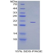 SDS-PAGE analysis of Human ADAMTS12 Protein.