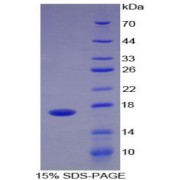 SDS-PAGE analysis of Human ADAMTS4 Protein.