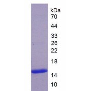 SDS-PAGE analysis of Human ADAMTS7 Protein.