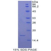 SDS-PAGE analysis of Rat ADAMTS7 Protein.