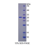 SDS-PAGE analysis of Mouse ADAMTS7 Protein.