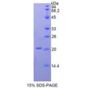 SDS-PAGE analysis of recombinant Human ACP3 Protein.