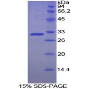 SDS-PAGE analysis of Rat ACP5 Protein.