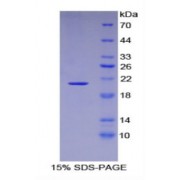SDS-PAGE analysis of Mouse Aconitase 1 Protein.