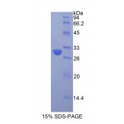 SDS-PAGE analysis of Rat Acrosin Protein.