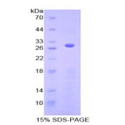 SDS-PAGE analysis of recombinant Human ACTC1 Protein.