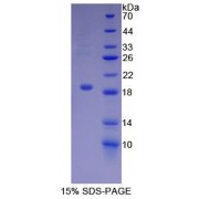 SDS-PAGE analysis of Mouse ACVR2A Protein.