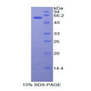 SDS-PAGE analysis of Human ADA Protein.