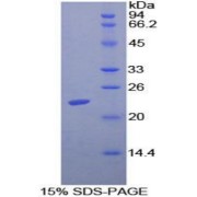 SDS-PAGE analysis of Mouse ADCYAP1 Protein.