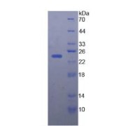 SDS-PAGE analysis of Human Afamin Protein.