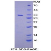 SDS-PAGE analysis of Mouse Alanine Aminopeptidase Protein.