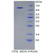 SDS-PAGE analysis of Rat Alanine Aminotransferase (ALT) Protein.