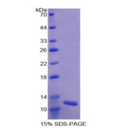 SDS-PAGE analysis of Human ALT2 Protein.