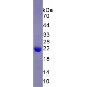 SDS-PAGE analysis of recombinant Mouse ADH1 Protein.