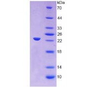 SDS-PAGE analysis of Human Orosomucoid 1 Protein.