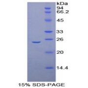 SDS-PAGE analysis of AMBP Protein.