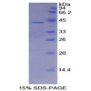 SDS-PAGE analysis of Human aHSG Protein.