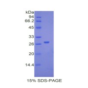 SDS-PAGE analysis of Mouse aHSG Protein.