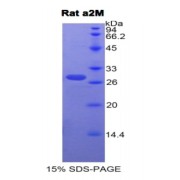 SDS-PAGE analysis of Rat alpha 2-Macroglobulin Protein.