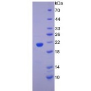 SDS-PAGE analysis of recombinant Human Spectrin Alpha Chain, Non-Erythrocytic 1 Protein.