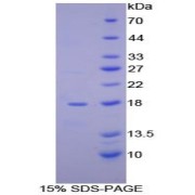 SDS-PAGE analysis of Human aHSP Protein.