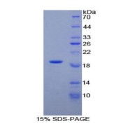 SDS-PAGE analysis of Rat alpha Lactalbumin Protein.