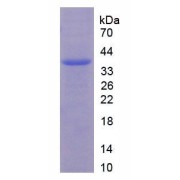 SDS-PAGE analysis of Human Androgen Receptor Protein.