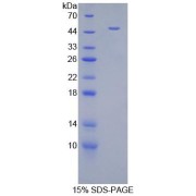 SDS-PAGE analysis of recombinant Mouse Androgen Receptor Protein.