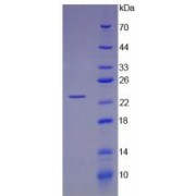 SDS-PAGE analysis of Mouse Angiopoietin 1 Protein.