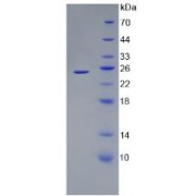 SDS-PAGE analysis of recombinant Human ANGPTL8.