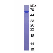 SDS-PAGE analysis of recombinant Mouse Angiostatin.