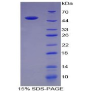 SDS-PAGE analysis of Pig ACE Protein.