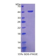 SDS-PAGE analysis of Mouse ACE2 Protein.